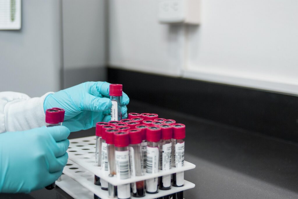 Healthcare professional organizing blood sample tubes in a laboratory for diagnostic testing and patient care.