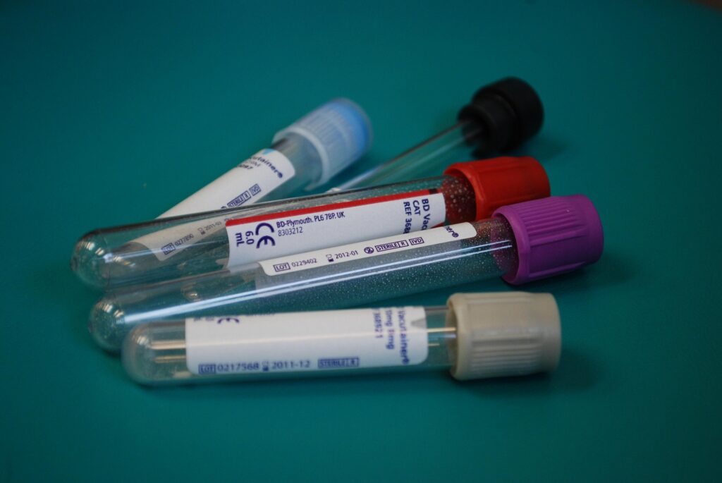 Blood collection tubes prepared for laboratory testing and diagnostic blood analysis.